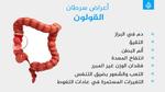 الرغبة في الطعام وعلاقتها بالسرطان