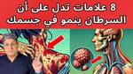 علامات تدل على سرطان العظام