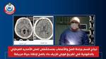 نجاح طبي في إنقاذ حياة مريض بالدقهلية