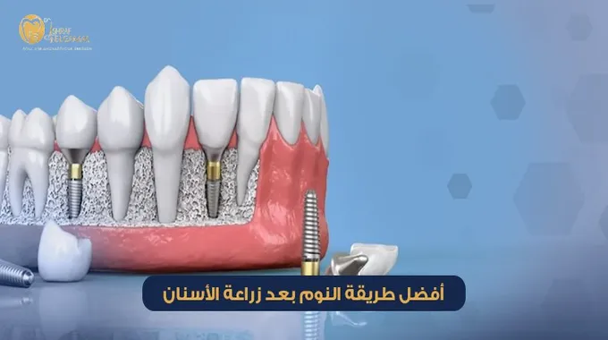 أهمية مدة تفريش الأسنان لصحة الفم