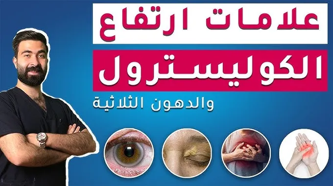 علامات ارتفاع الكوليسترول وأسبابه