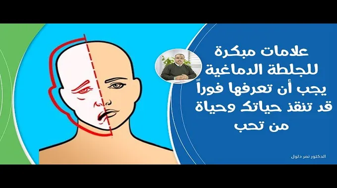 علامات تحذيرية مبكرة للسكتة الدماغية