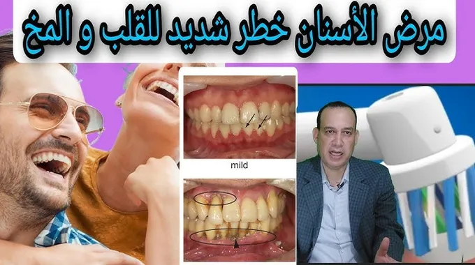 فقدان الأسنان وزيادة خطر الوفاة