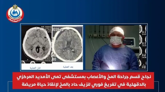 نجاح طبي في إنقاذ حياة مريض بالدقهلية